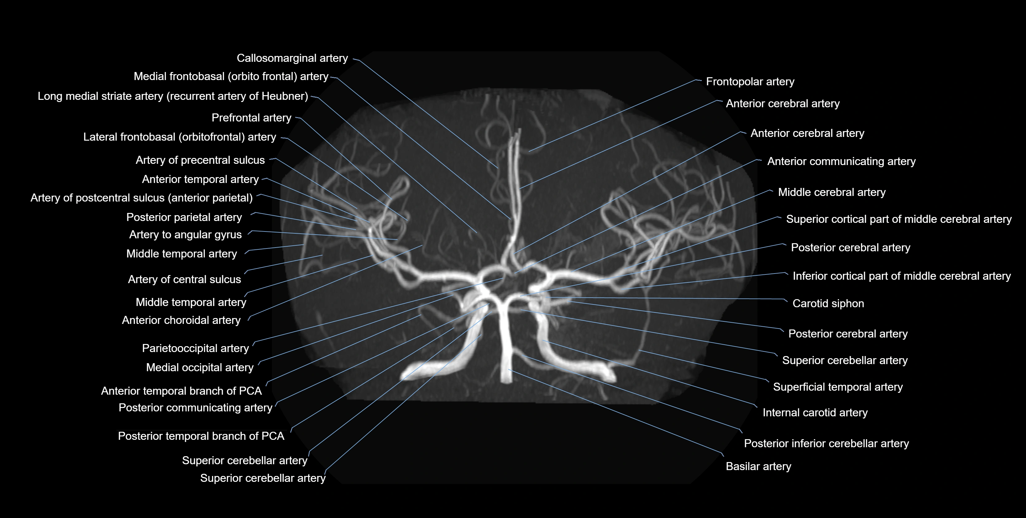 MRA brain axial MIP labelled  anatomy 3T MRI images -img-01021-00007.webp